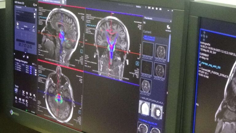 Tecnici di radiologia medica: il 10% andrà in pensione entro pochi anni
