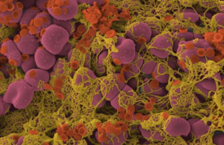 Dalla ricerca Iit e Galliera arrivano le nanoparticelle per curare l’ictus