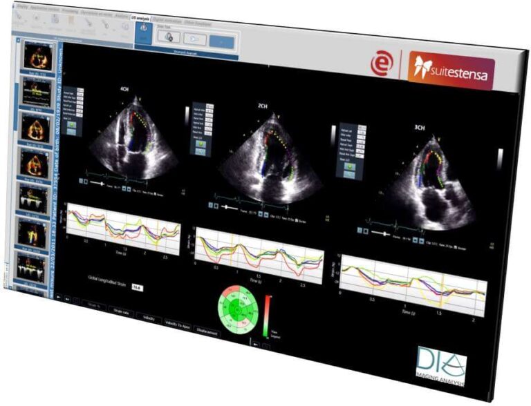 Ebit (Esaote) e DiA Imaging Analysis, partnership per analisi ecocardiografica