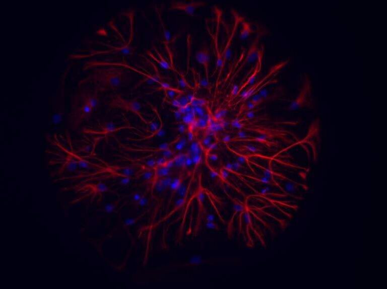 Iit e Unige: create nanoparticelle utili per evitare la morte cellulare dei neuroni sovraeccitati