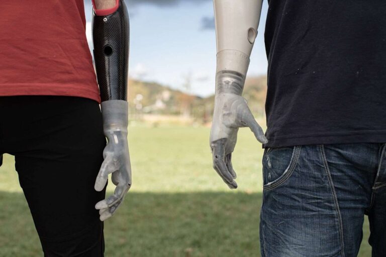 L’Iit alle cyborg olimpiadi con due dispositivi per i movimenti della mano