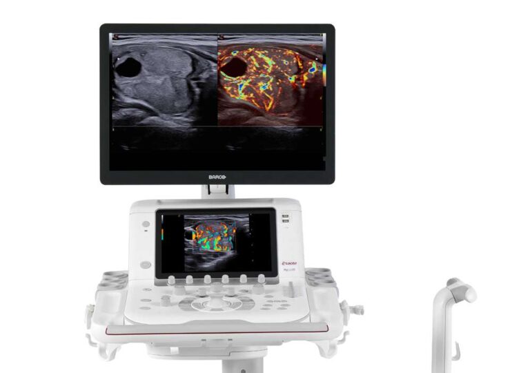 Esaote: completata in anticipo la transizione dei dispositivi medicali alla certificazione Mdr