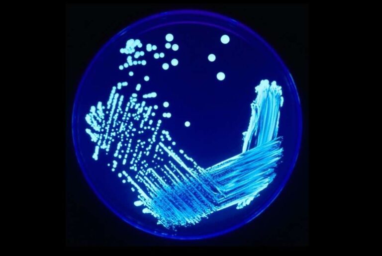 Salute, venerdì 12 aprile alla Spezia seminario sulla legionella