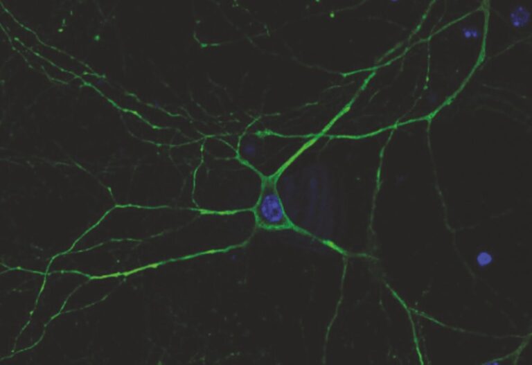 Epilessia: un ricerca IIT, San Martino e Unige ispirata dalle lucciole dà nuove speranze di terapie