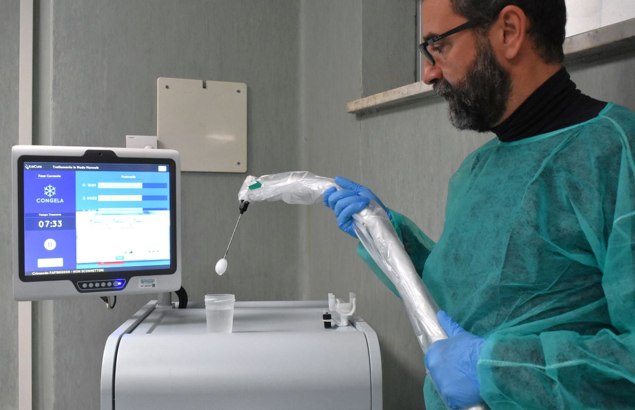 Tumori al seno, al San Martino una nuova procedura che utilizza il freddo
