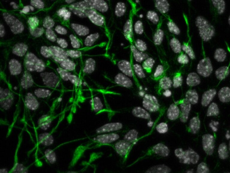 Iit, uno studio internazionale dimostra il ruolo cruciale della proteina METTL9 per il corretto sviluppo dei neuroni