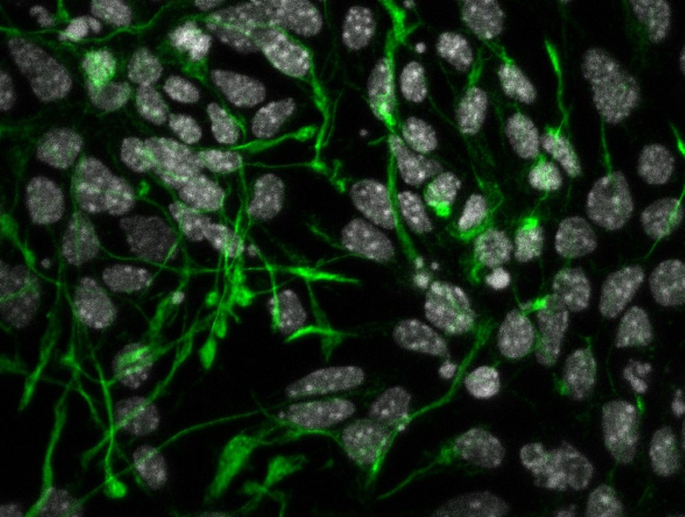 Iit, uno studio internazionale dimostra il ruolo cruciale della proteina METTL9 per il corretto sviluppo dei neuroni